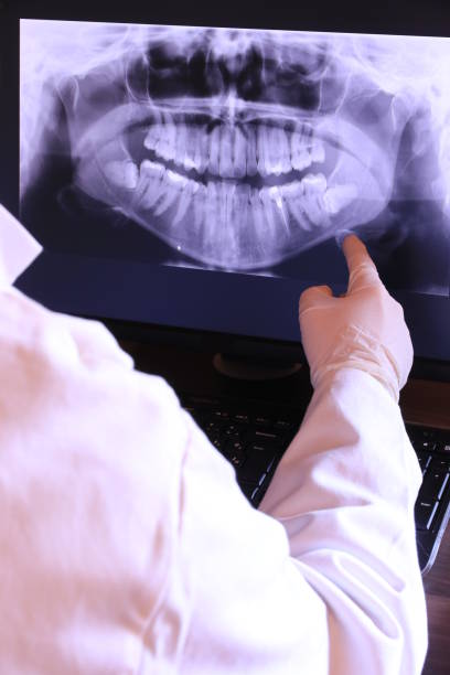 Best Teeth Whitening  in Gnadenhutten, OH