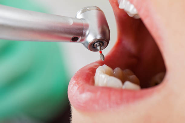 Best Knocked-Out Tooth Emergency  in Gnadenhutten, OH